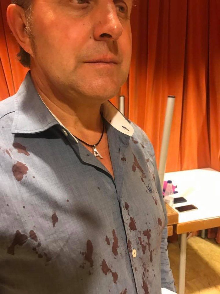 El tinent d'alcalde Jaume Bernis, amb sang a la camisa.